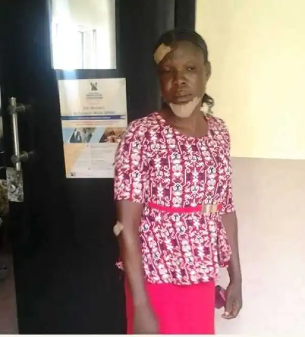 Woman Breaks Neighbour